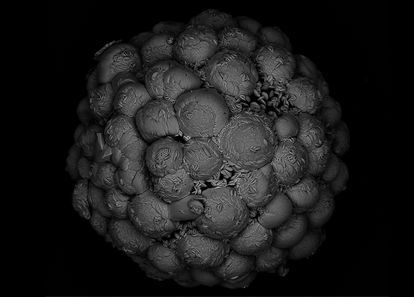A black and white 3D microscope image of a sphere made up of lots of little spheres covered in little specks resembling seeds A black and white 3D microscope image of a sphere made up of lots of little spheres covered in little specks resembling seeds