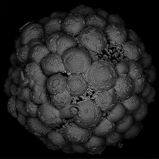 A black and white 3D microscope image of a sphere made up of lots of little spheres covered in little specks resembling seeds A black and white 3D microscope image of a sphere made up of lots of little spheres covered in little specks resembling seeds
