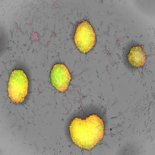 grey back ground with yellow blobs on it. One blob is clearly heart shaped grey back ground with yellow blobs on it. One blob is clearly heart shaped